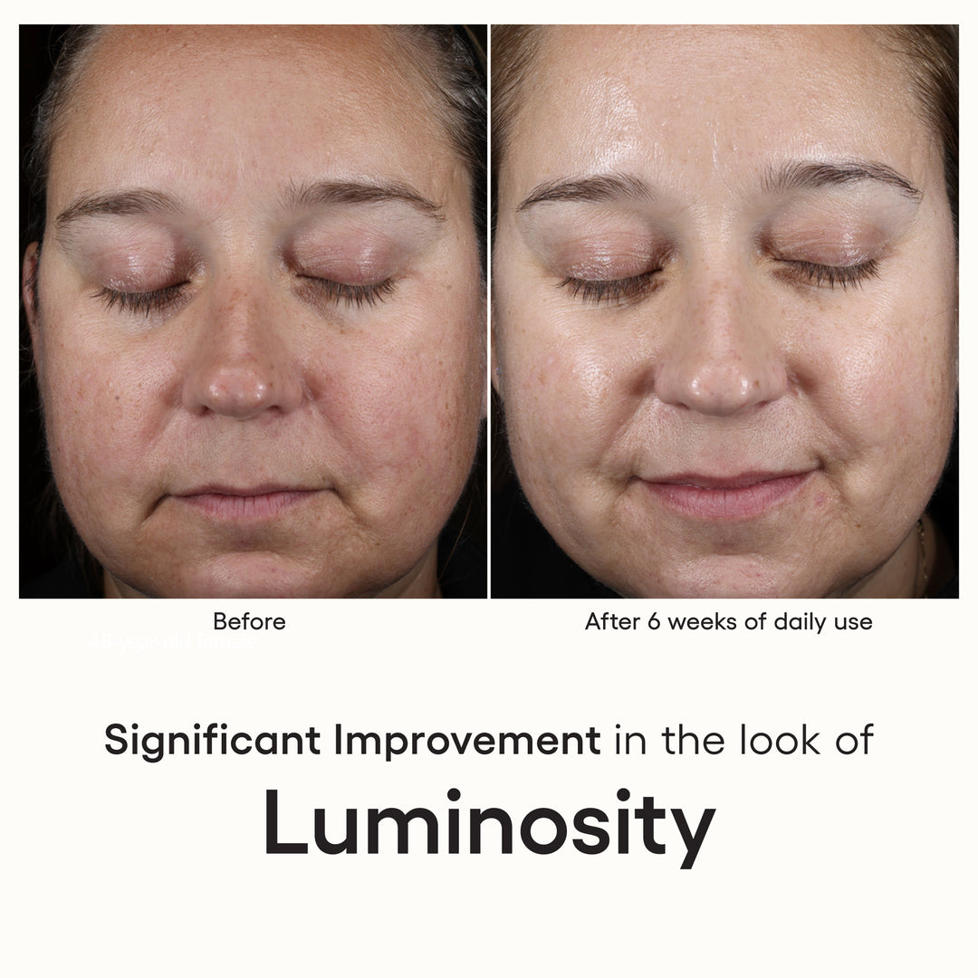 ( plated )™ Skin Science INTENSE